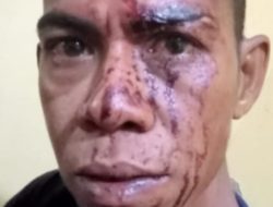 Disinyalir Upaya Persuasif Polisi Membalikkan Kasus KRIMINAL